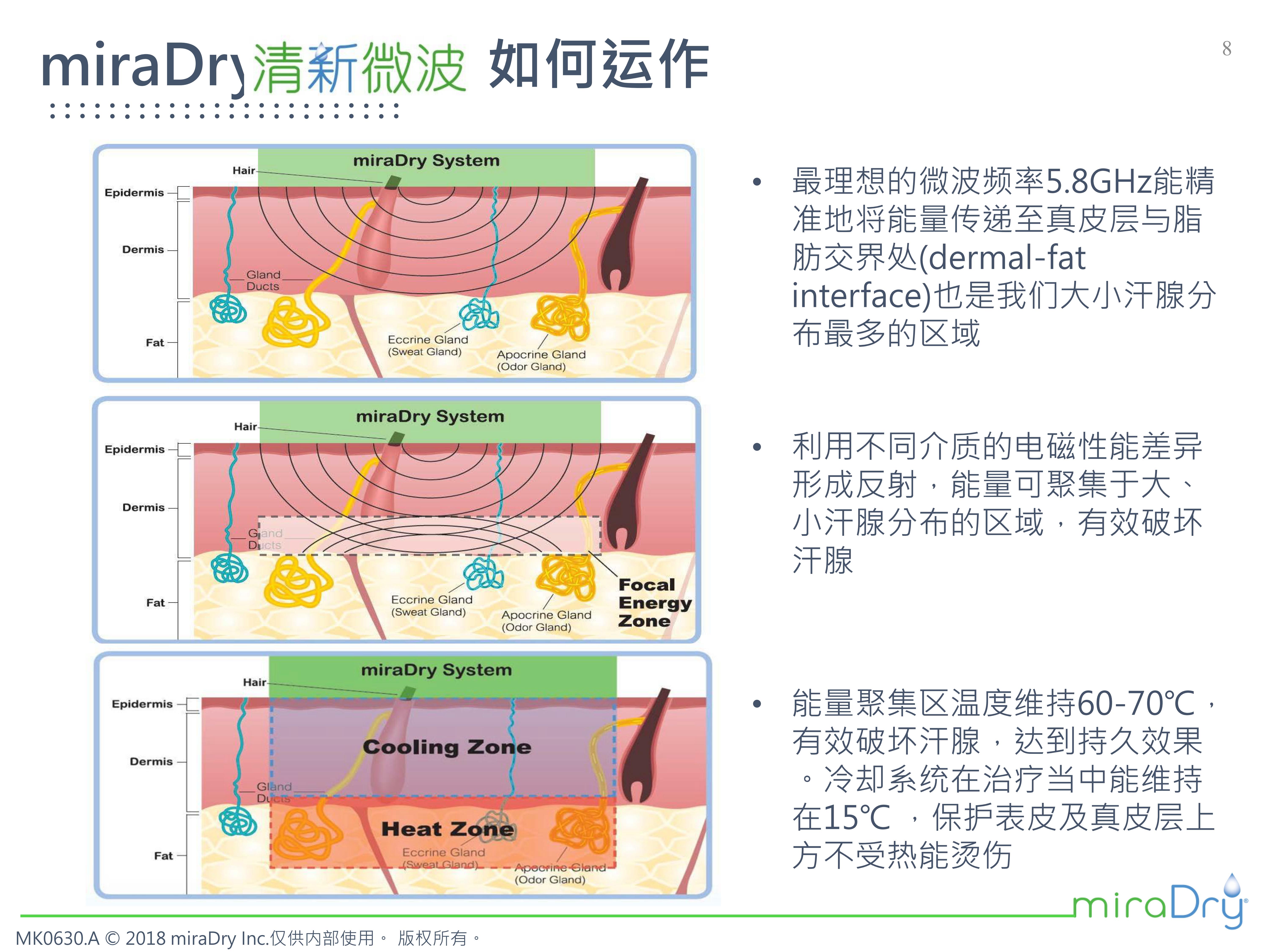 miradry微波治疗腋臭会复发吗,miradry和黄金微针哪个治疗腋臭好
