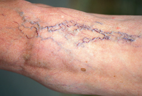 身体有病胯骨先知,身体有病双腿先知