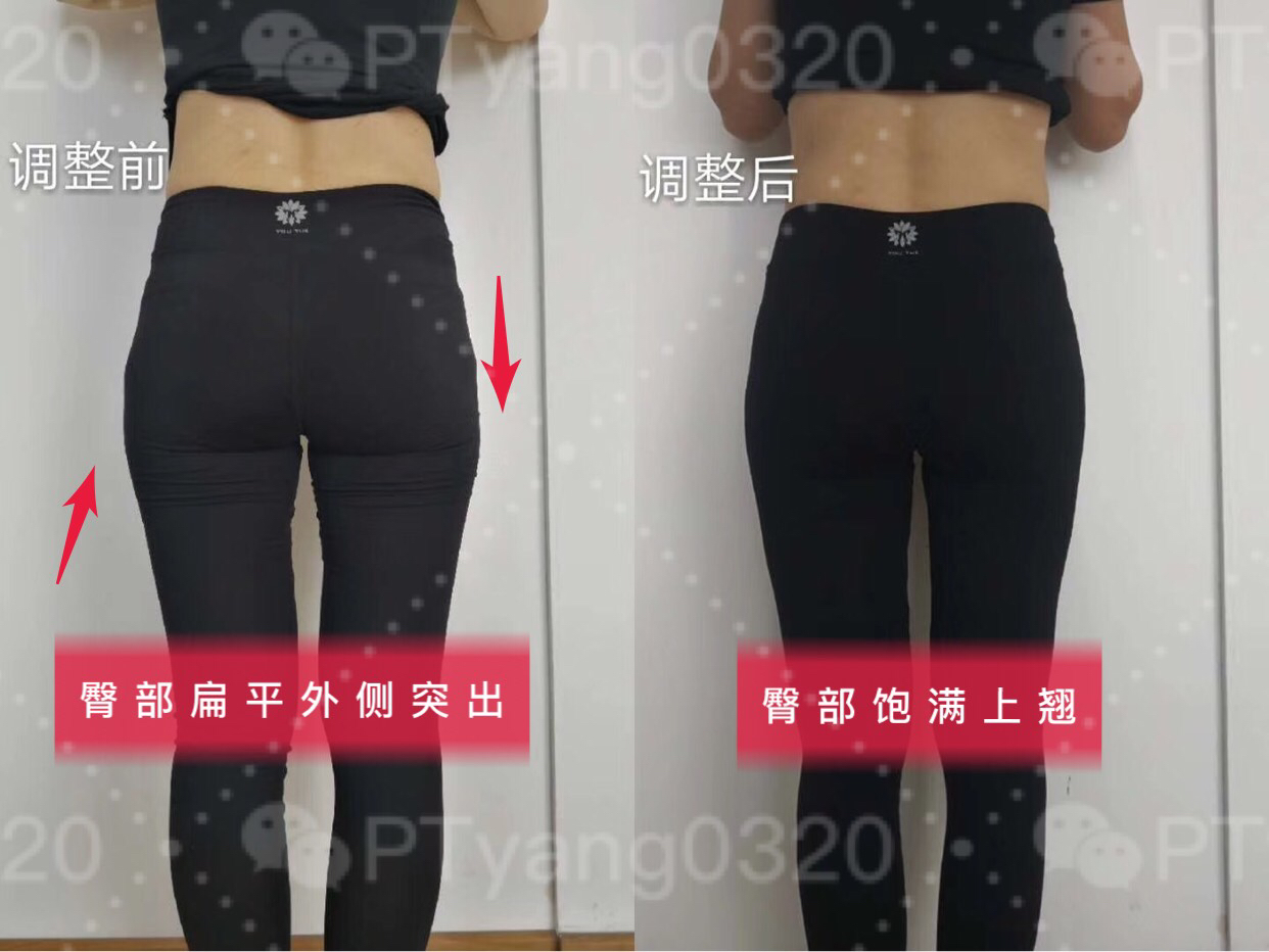 大腿外侧凸起怎么穿搭,大腿内侧两块赘肉穿裤子很难看