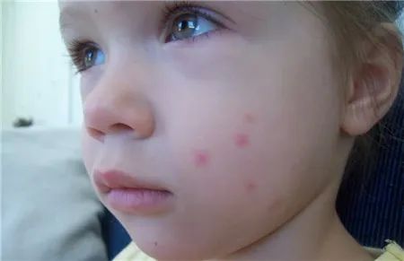 夏天家里蚊子多教你一招不用蚊香,很多人不懂蚊子怕什么