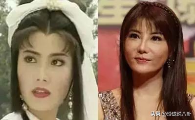 有哪些明星过度整容惨不忍睹,整容失败女明星今昔对比