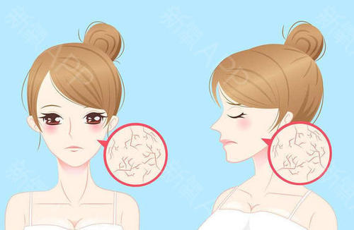 葛林若芙蓉霜自检,葛林若芙蓉霜按压手法