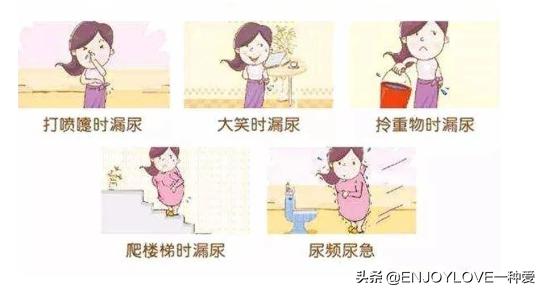 产后漏尿,都是盆底肌损伤惹的祸