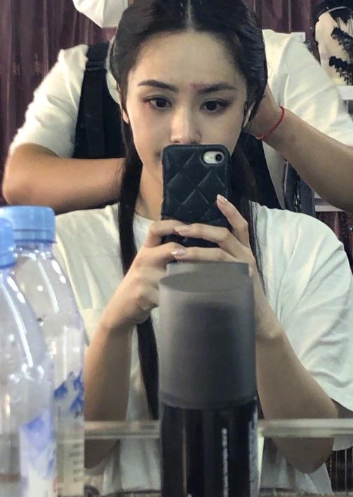 医美专家爆阿娇6㎝伤口肯定留疤痕，激光也难以恢复平滑肌肤