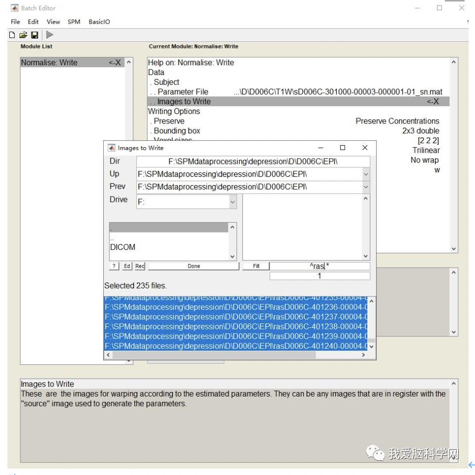 脑功能报告解读,颅脑mri信号讲解视频教程