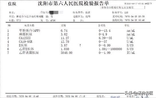 肝癌做放射性粒子治疗有什么影响,乏力查出来癌症