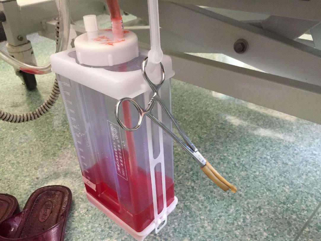 恶性肿瘤胸腔积液严重吗,恶性胸腔积液可以打药吗