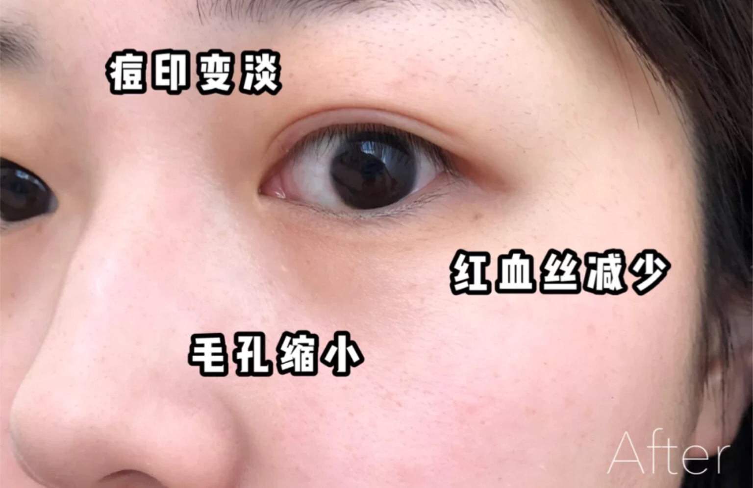 绿宝瓶pro是什么,绿宝瓶pro怎么买划算