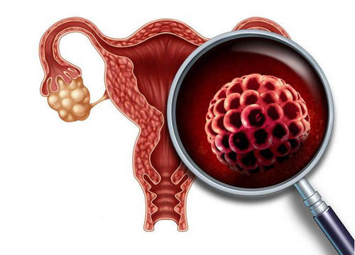 什么是早发性卵巢功能不全?如何治疗?