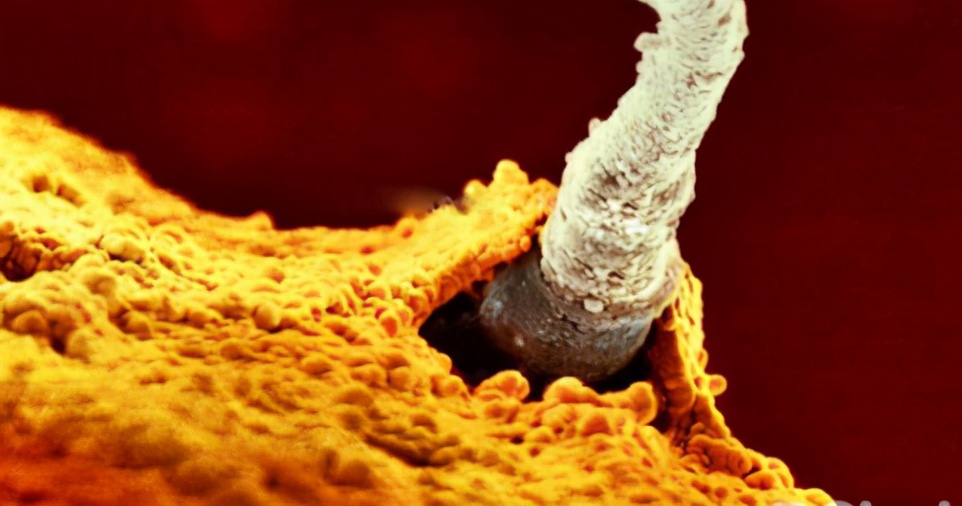 生命萌芽，就充满争斗攻击伤痛：你的出生，已经PK赢了千军万马