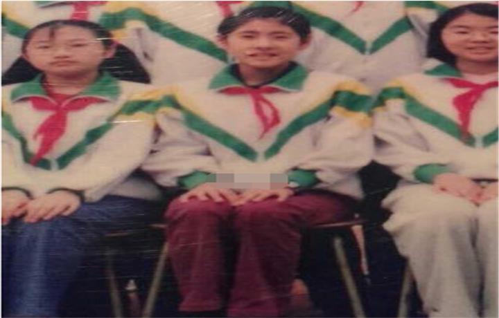 张碧晨鼻子是怎么回事,张碧晨鼻子到底怎么回事