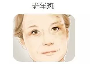 再美的脸，也抵挡不住“加斑”的困扰