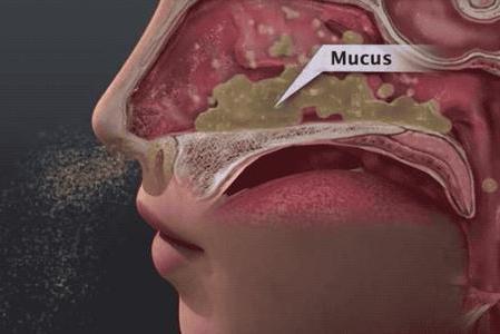 爱挖鼻孔的人或早或晚,每个爱挖鼻孔的人面临4个后果