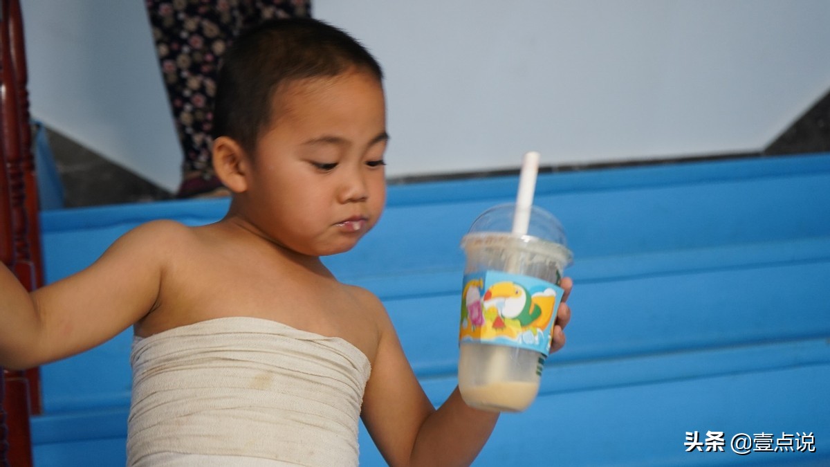 意外毁容真实案例,因为一次意外毁了女孩的一生