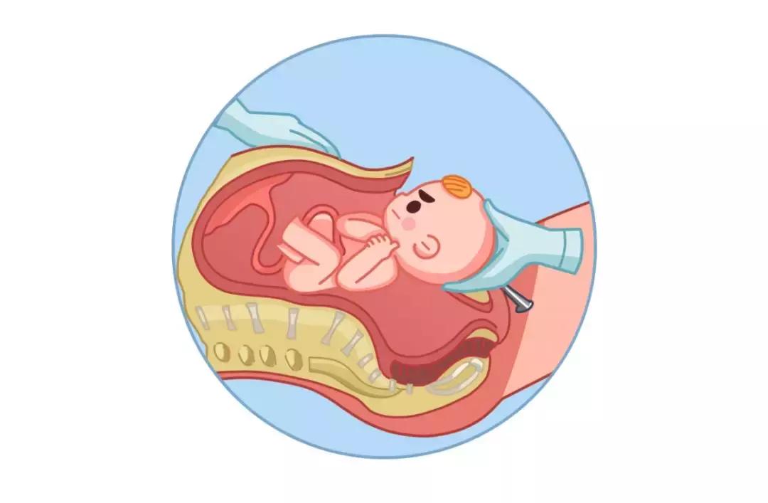 产妇恶露颜色呈青色,恶露是什么颜色说明已经排干净了