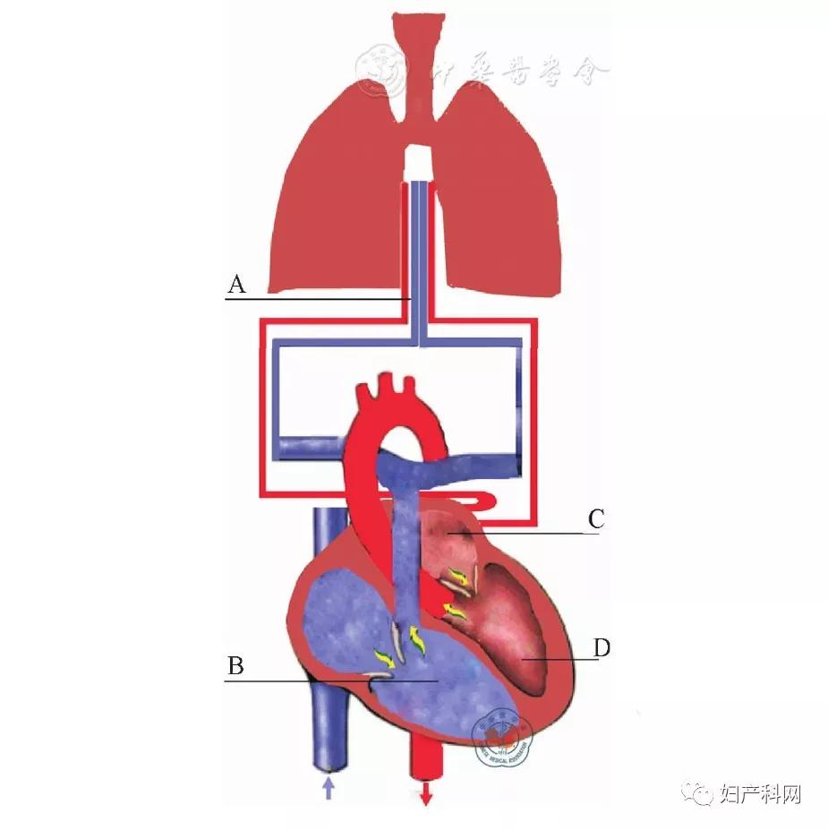 羊水栓塞诊疗规范2018,羊水栓塞的诊断及处理课件