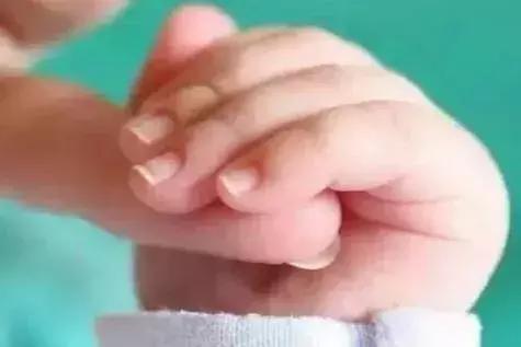 科普|宝宝指甲凹凸不平怎么办，营养补给和卫生习惯能解决！