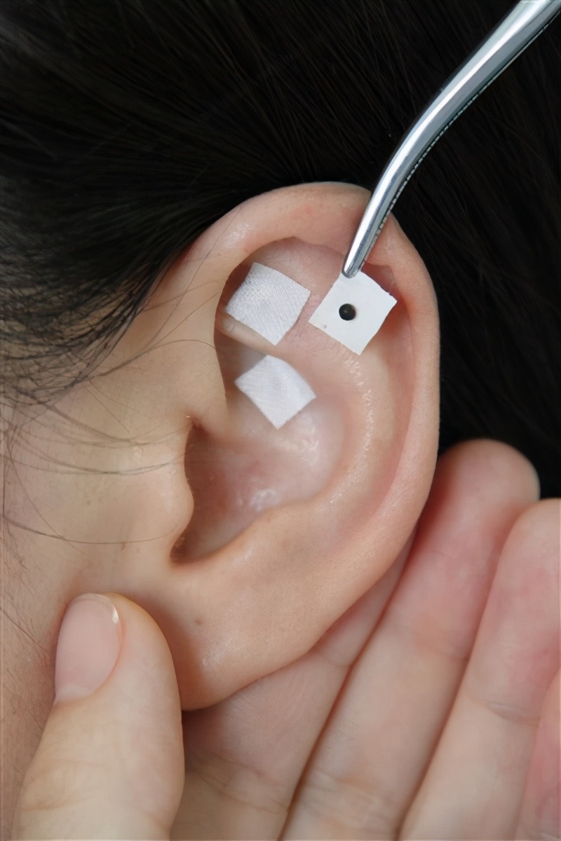 中医药在试管移植前的具体应用