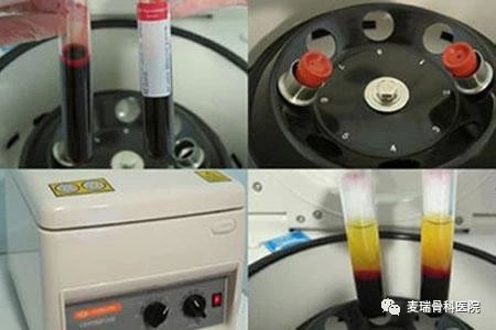 关节肌肉肿胀僵硬疼痛吃什么药,关节疼痛压痛僵硬关节肿胀