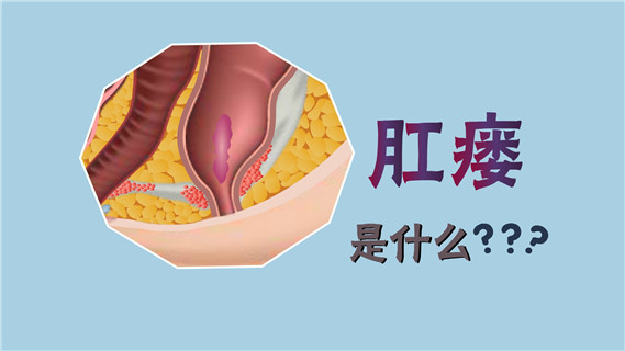 肛瘘可以暂时不治疗么,肛瘘必须做手术吗可以用中药吗