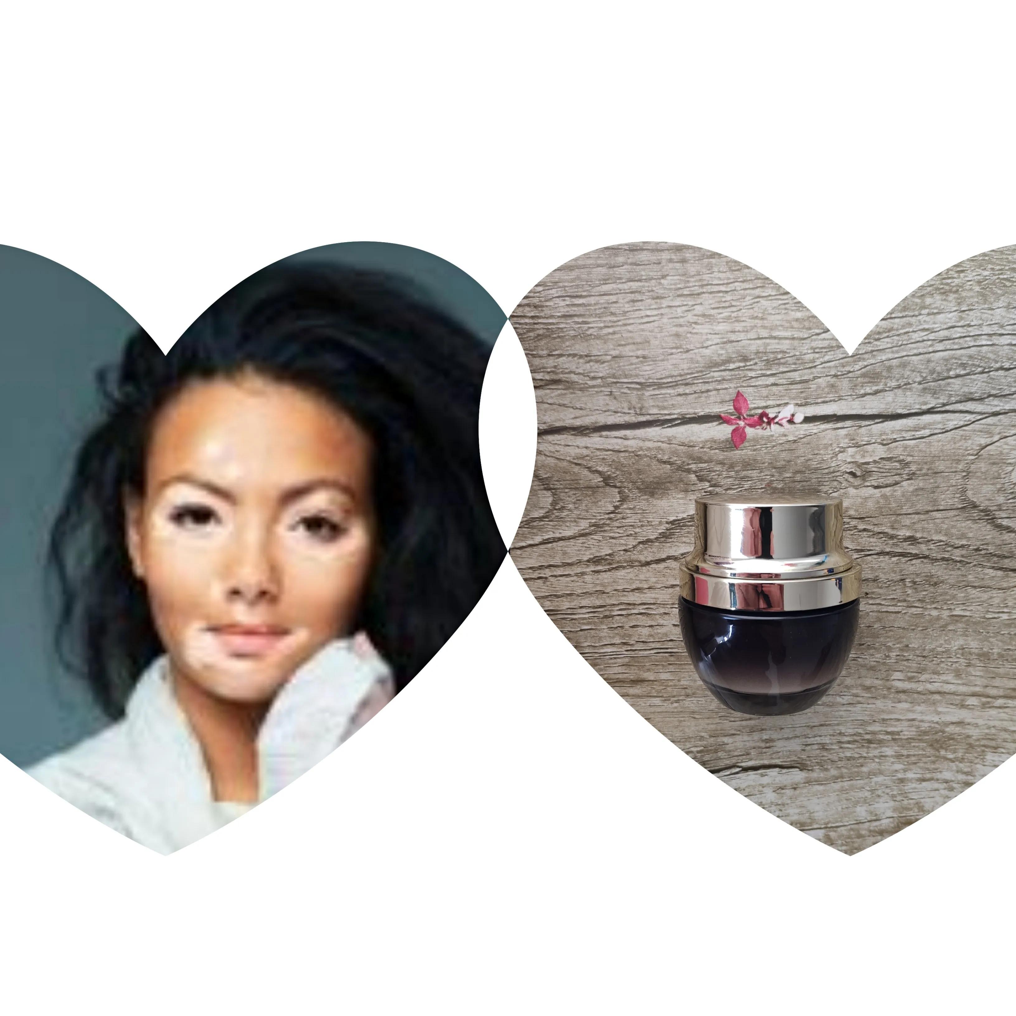 治白癜风外用软膏,白癜风外用效果好