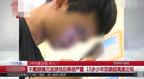 15岁近视就有了700多度怎么办,15岁眼睛近视900度要怎么办