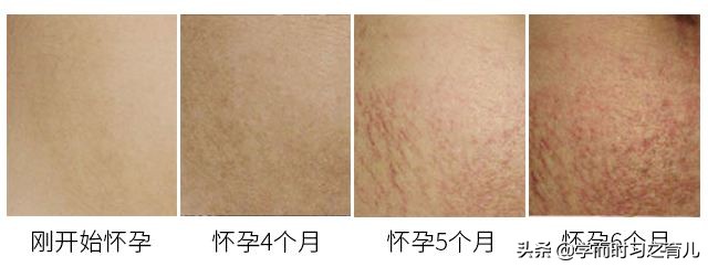 怀孕7个月孕妇身体可能出现的7个变化,最后2个是异常情况