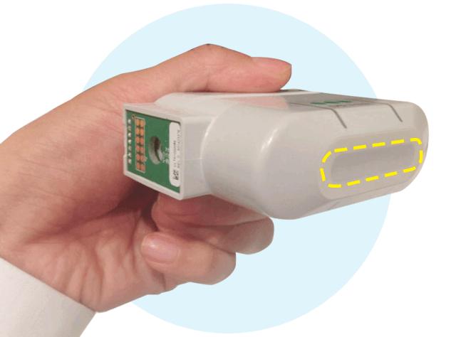 张雨绮说做超声刀就像在烤肉?我去体验了一把……