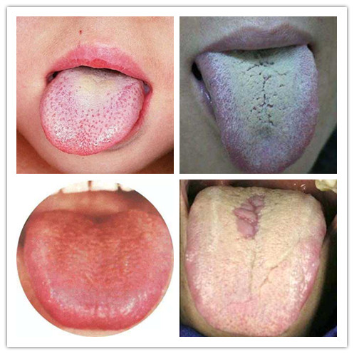 归脾丸吃错了胃胀气,人参归脾丸的四大误区