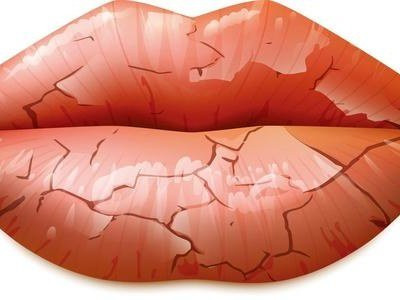 医生说唇炎涂什么,涂口红导致的唇炎怎么治