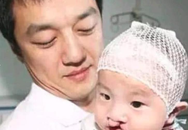 李嫣兔唇是不是很严重,李嫣兔唇现在怎么样了