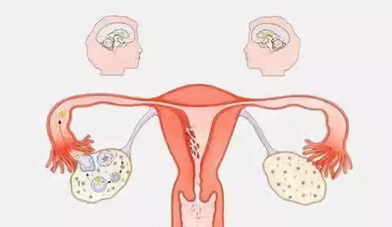 女人上环后身体会排斥,三招做好保养!你都知道?