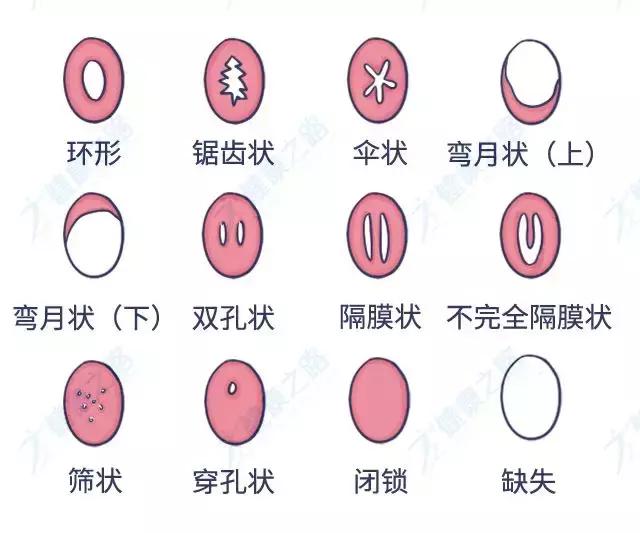 姨妈用品都有哪些,姨妈神器正确用法