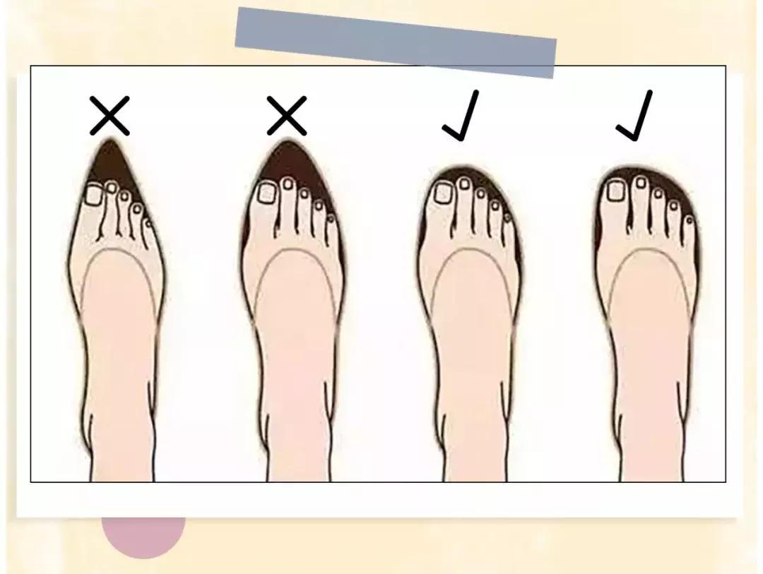 选鞋子技巧图片,有几种脚型怎样选鞋子