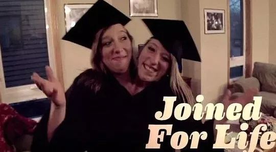 诡异双头人,最诡异的双头连体人