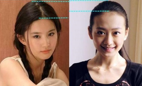 刘亦菲颅顶怎么那么高,刘亦菲高颅顶和低颅顶的区别图片