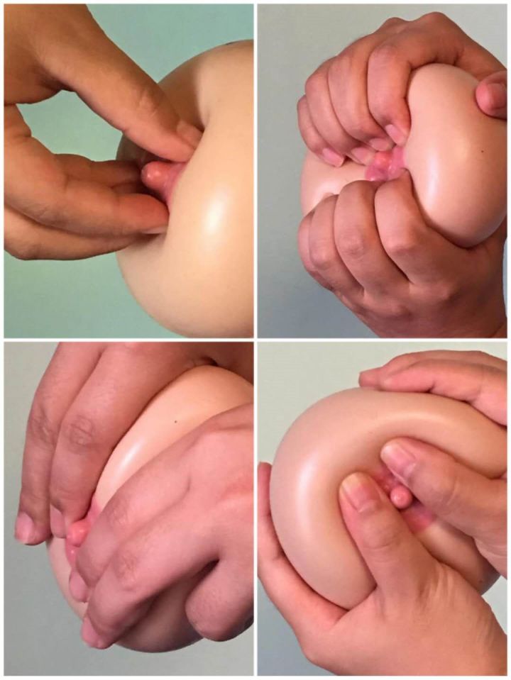 产后腋下有疙瘩是乳腺不通吗,产后乳腺不通敷药