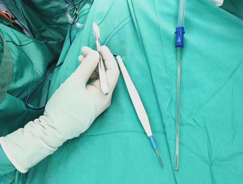 高频电刀最新视频,关于电刀的段子