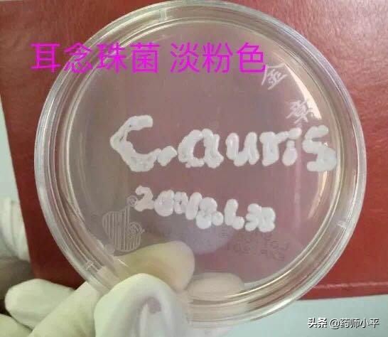 美国发现罕见真菌感染病例,感染100天后死亡率