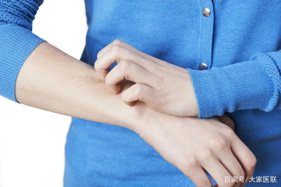 湿疹总是反反复复中医教你辨证,湿疹老是反反复复怎么办呢