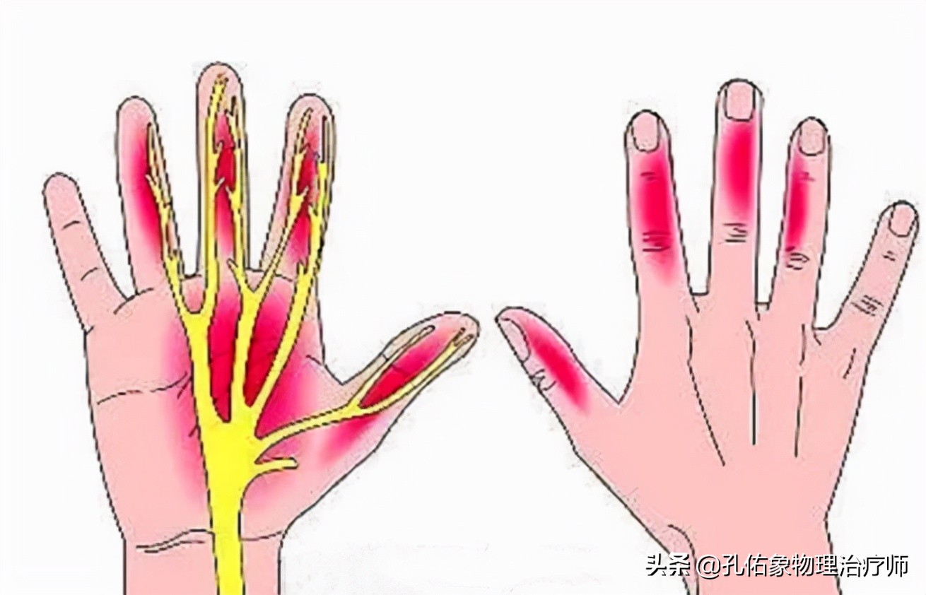 手部麻木长时间不缓解是什么原因,手部麻木无力怎么办