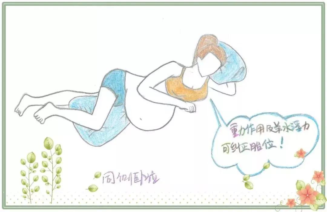 自由体位分娩助产技术,助产创意图片