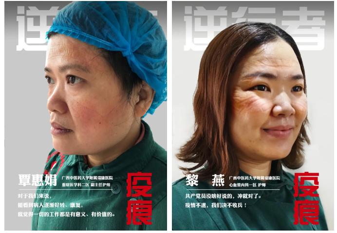 广西中医药大学附属瑞康医院好么,广西中医药大学附属瑞康医院病历