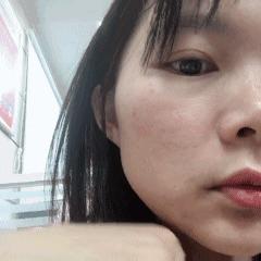 隐形眼镜戴上了怎么还摘不下来了,隐形眼镜摘也难吗