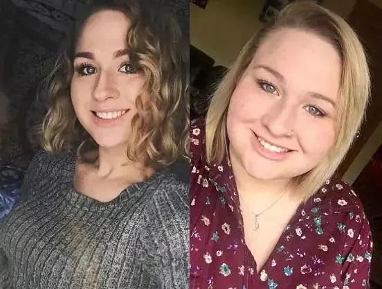 缩胃减肥前后对比,360斤缩胃手术一年减肥成功案例