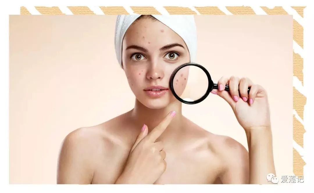 修复痘疤的药,修复痘疤痘坑用什么产品好