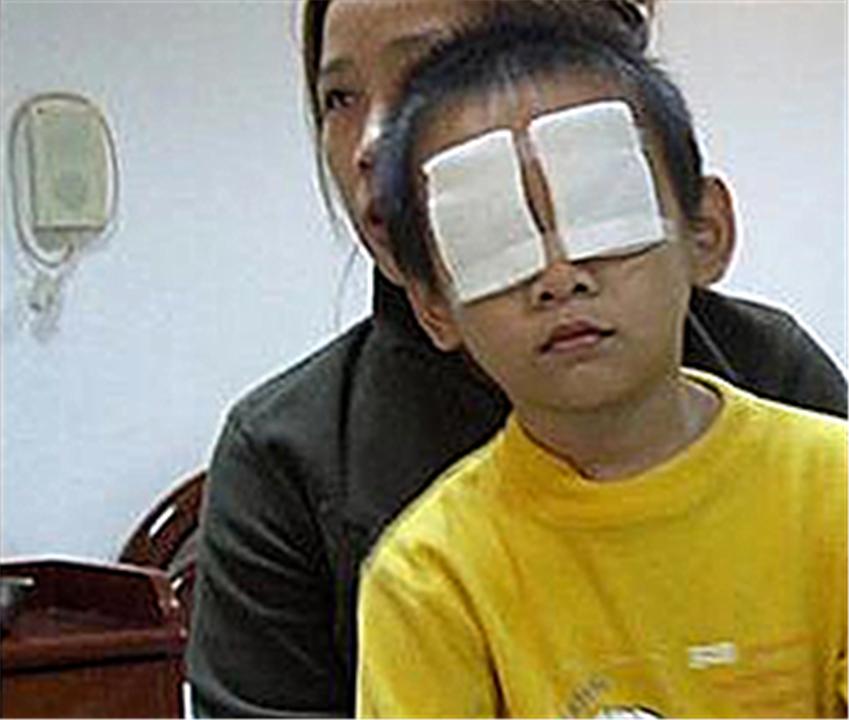 3岁孩子眼睛进了石灰,妈妈第一时间这样处理,医生看了都点赞