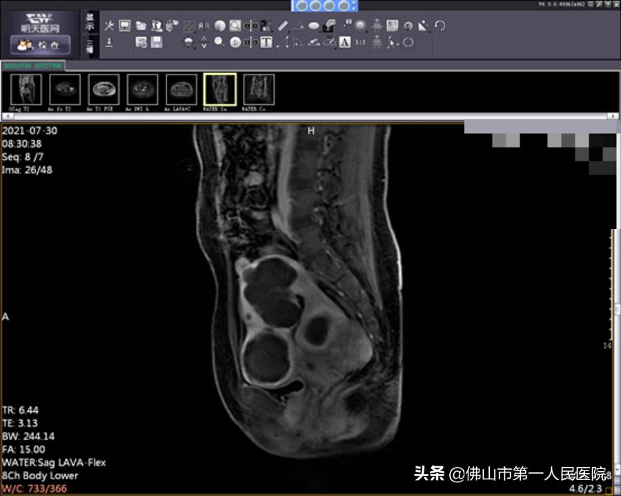 这把“刀”能隔山打“牛”,呵护子宫,带来好“孕”