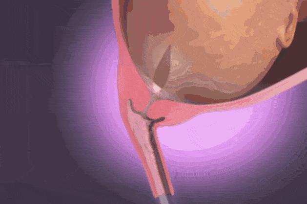 孕妇胎儿动图,3d动图视频怎么做