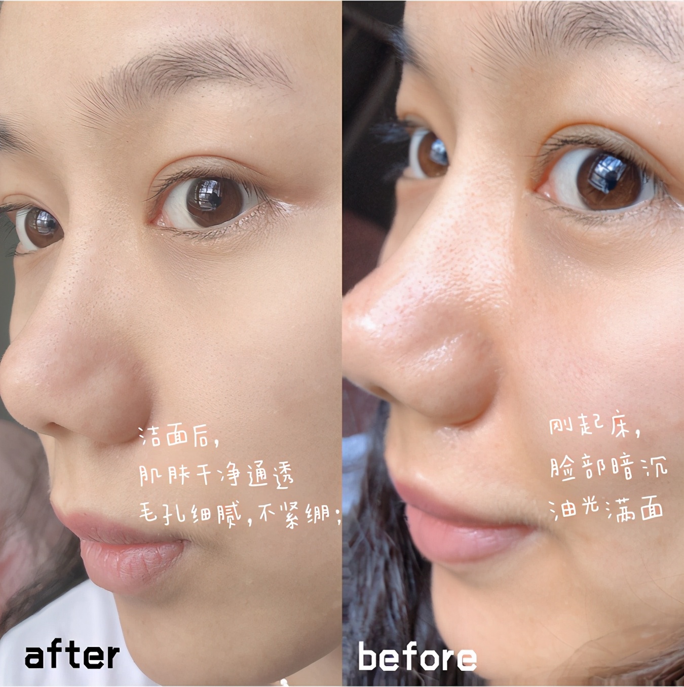 雅诗兰黛洗面奶红石榴能祛痘痘吗,雅诗兰黛红石榴洗面奶去黑头么